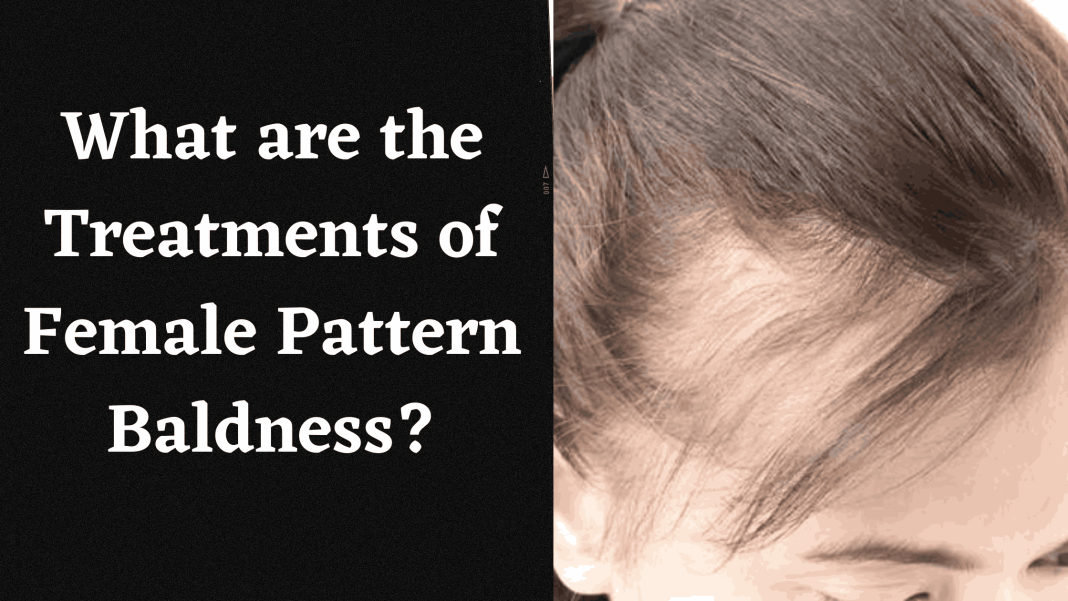 Pattern Baldness