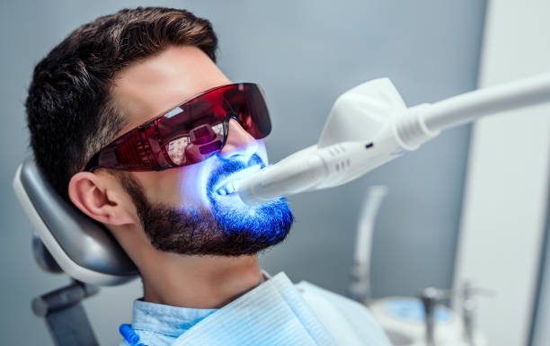 Little Known Ways to TEETH WHITENING BLEACH REFILLS Teeth whitening bleach refills